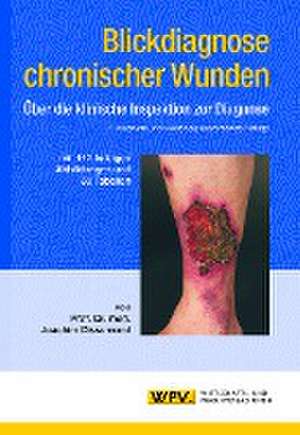 Blickdiagnose chronischer Wunden de Joachim Dissemond