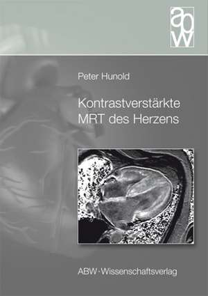 Kontrastverstärkte MRT des Herzens de Peter Hunold