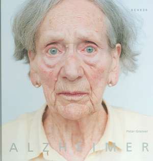 Alzheimer de Christoph Ribbat