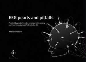 EEG pearls and pitfalls de Andrea O. Rossetti