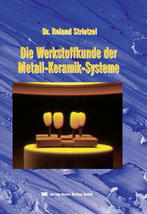 Werkstoffkunde der Metall-Keramik-Systeme de Roland Strietzel