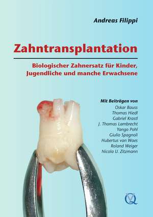 Zahntransplantation: Biologischer Zahnersatz für Kinder, Jugendliche und manche Erwachsene de Andreas Filippi