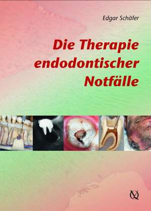 Die Therapie endodontischer Notfälle de Edgar Schäfer