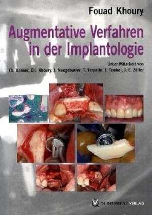 Augmentive Verfahren in der oralen Implantogie de Fouad Khoury