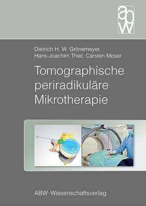 Tomographische periradikuläre Mikrotherapie de Dietrich Grönemeyer