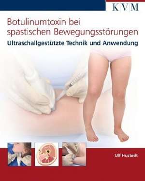 Botulinumtoxin bei spastischen Bewegungsstörungen de Ulf Hustedt