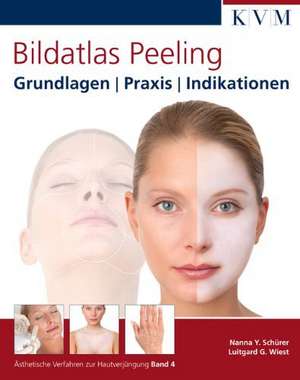 Bildatlas Peeling de Nanna Y. Schürer