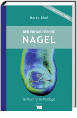 Der eingewachsenen Nagel de Maren Bloß