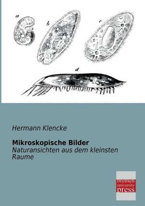 Mikroskopische Bilder de Hermann Klencke