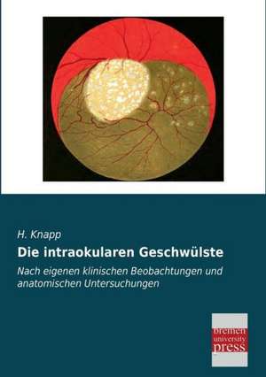 Die intraokularen Geschwülste de H. Knapp