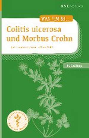 Colitis ulcerosa und Morbus Crohn de Jost Langhorst