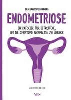 Endometriose de Francisco Carmona