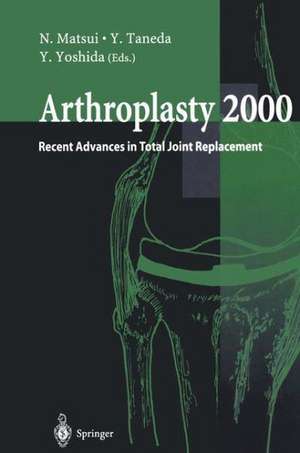 Arthroplasty 2000: Recent Advances in Total Joint Replacement de N. Matsui