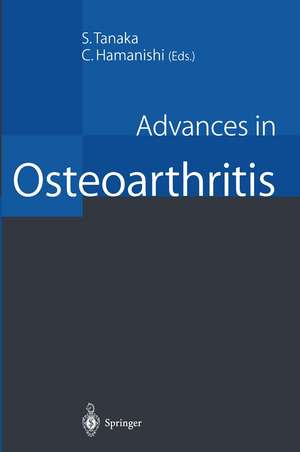 Advances in Osteoarthritis de Seisuke Tanaka