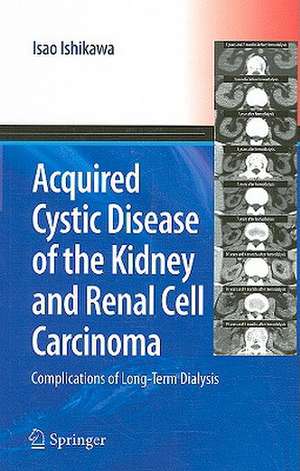 Acquired Cystic Disease of the Kidney and Renal Cell Carcinoma: Complication of Long-Term Dialysis de Isao Ishikawa