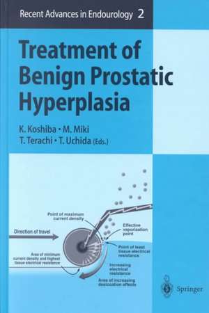 Treatment of Benign Prostatic Hyperplasia de K. Koshiba