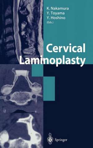 Cervical Laminoplasty de K. Nakamura