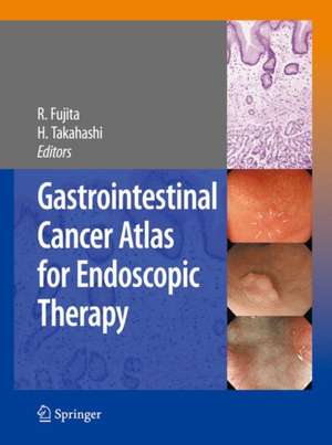 Gastrointestinal Cancer Atlas for Endoscopic Therapy de Rikiya Fujita