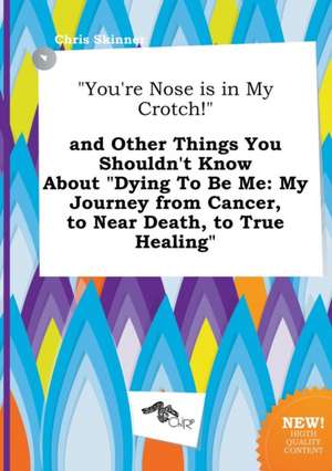 You're Nose Is in My Crotch! and Other Things You Shouldn't Know about Dying to Be Me: My Journey from Cancer, to Near Death, to True Healing de Chris Skinner