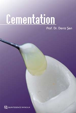 Cementation de Deniz Sen