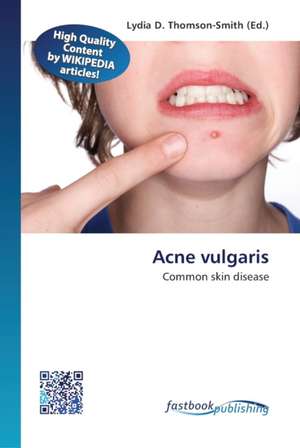 Acne vulgaris de Lydia D Thomson-Smith