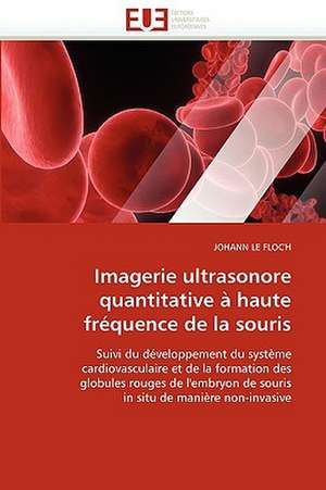 Imagerie ultrasonore quantitative à haute fréquence de la souris de JOHANN LE FLOC'H