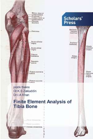 Finite Element Analysis of Tibia Bone de Pratik Thakre