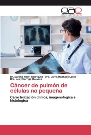 Cáncer de pulmón de células no pequeña de Euridys Mauri Rodríguez