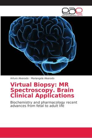 Virtual Biopsy: MR Spectroscopy. Brain Clinical Applications de Arturo Alvarado