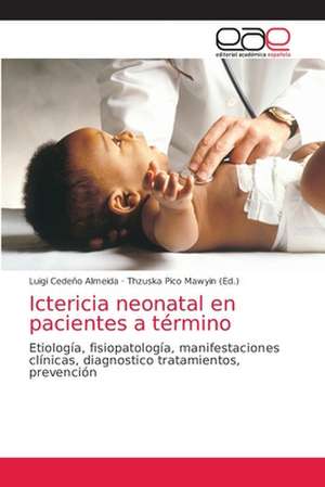 Ictericia neonatal en pacientes a término de Luigi Cedeño Almeida