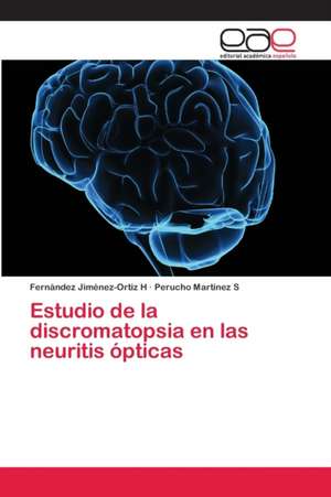 Estudio de la discromatopsia en las neuritis ópticas de Fernández Jiménez-Ortiz H