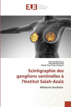 Scintigraphie des ganglions sentinelles à l'Institut Salah-Azaïz de Chaima Dachraoui