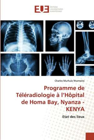 Programme de Téléradiologie à l¿Hôpital de Homa Bay, Nyanza - KENYA de Charles Murhula Ntamwira