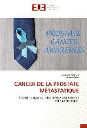 CANCER DE LA PROSTATE MÉTASTATIQUE de Soudani Sabrine