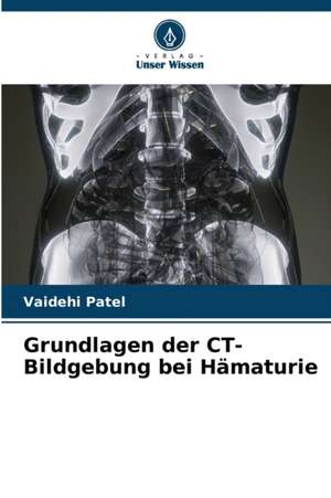 Grundlagen der CT-Bildgebung bei Hämaturie de Vaidehi Patel