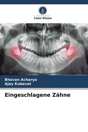 Eingeschlagene Zähne de Bhavan Acharya