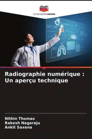 Radiographie numérique : Un aperçu technique de Nithin Thomas