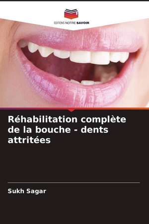 Réhabilitation complète de la bouche - dents attritées de Sukh Sagar