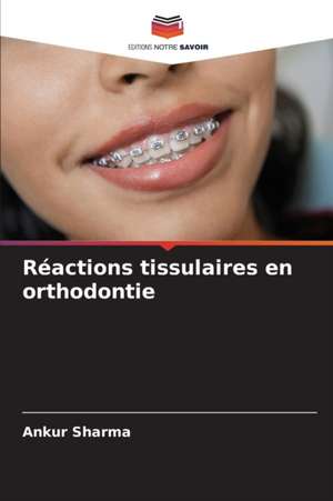 Réactions tissulaires en orthodontie de Ankur Sharma