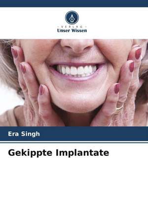 Gekippte Implantate de Era Singh