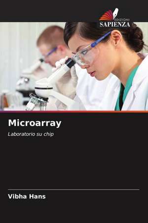 Microarray de Vibha Hans