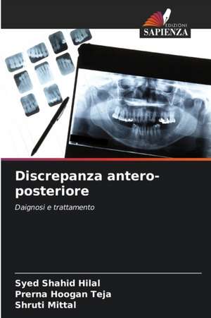 Discrepanza antero-posteriore de Syed Shahid Hilal