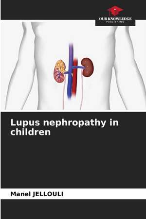 Lupus nephropathy in children de Manel Jellouli