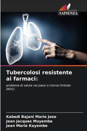 Tubercolosi resistente ai farmaci: de Kabedi Bajani Marie Jose