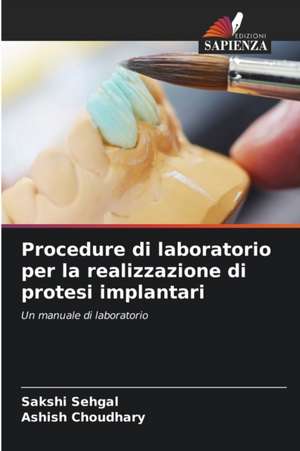 Procedure di laboratorio per la realizzazione di protesi implantari de Sakshi Sehgal