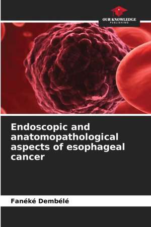 Endoscopic and anatomopathological aspects of esophageal cancer de Fanéké Dembélé