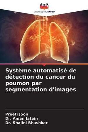 Système automatisé de détection du cancer du poumon par segmentation d'images de Preeti Joon