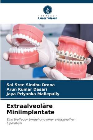 Extraalveoläre Miniimplantate de Sai Sree Sindhu Drona