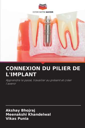 CONNEXION DU PILIER DE L'IMPLANT de Akshay Bhojraj