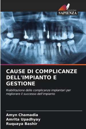 CAUSE DI COMPLICANZE DELL'IMPIANTO E GESTIONE de Amyn Chamadia